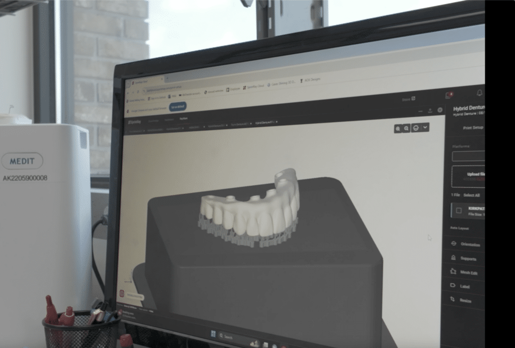 3d digital printing for the new teeth now same-day teeth